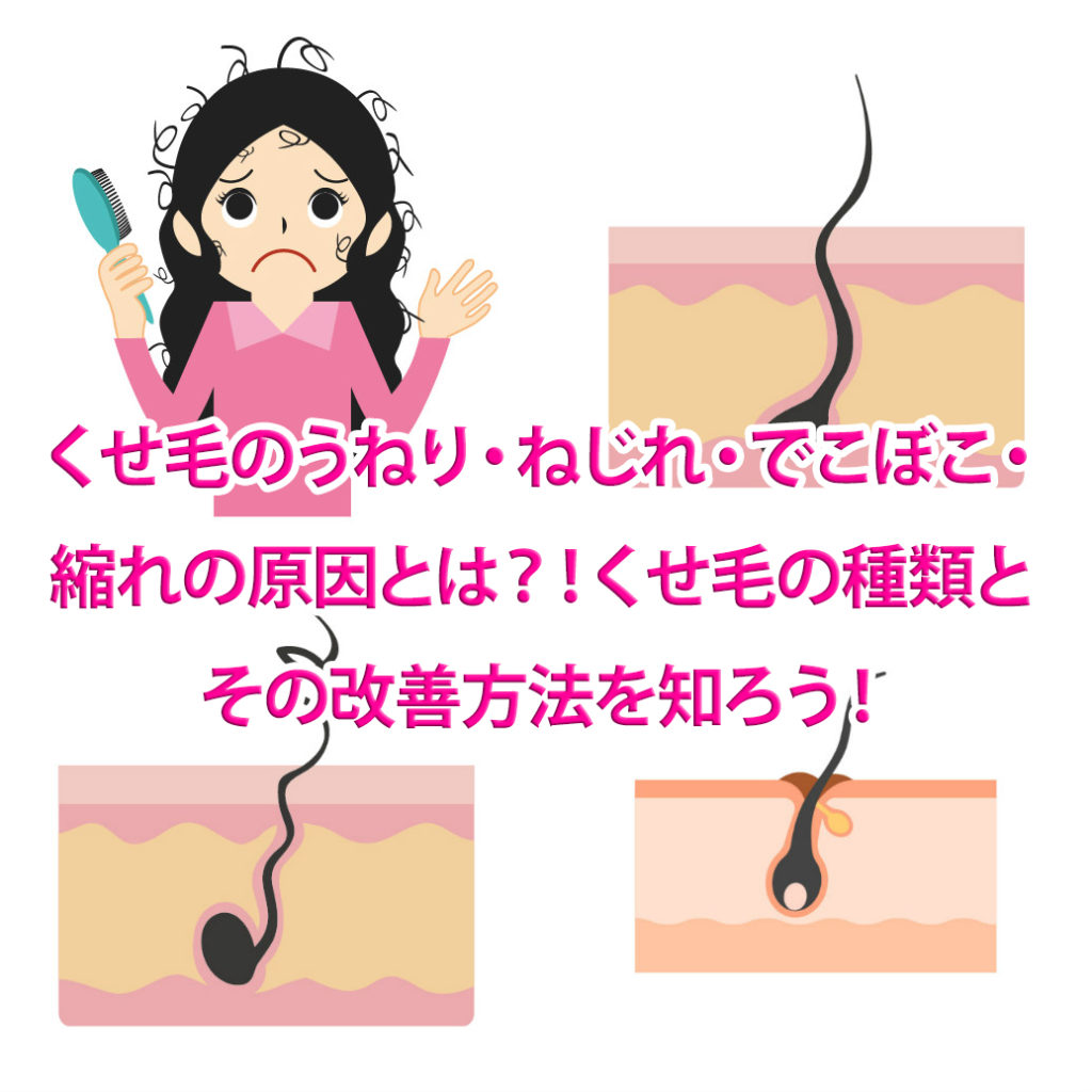 くせ毛のうねり ねじれ でこぼこ 縮れの原因とは くせ毛の種類とその改善方法を知ろう 大阪の髪 質改善専門美容室dran ドラン 大阪市中央区森ノ宮 東大阪